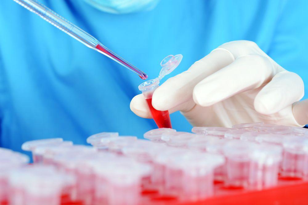 prostatite e globuli bianchi altissimo prostatite e globuli bianchi altissimo